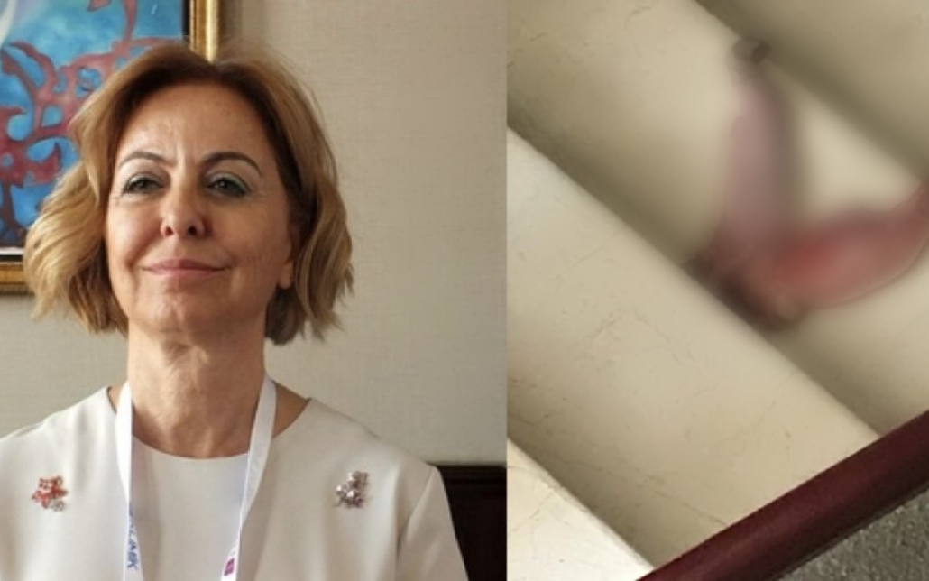 Esin Davutoğlu Şenol’u tehdit eden şahıs serbest