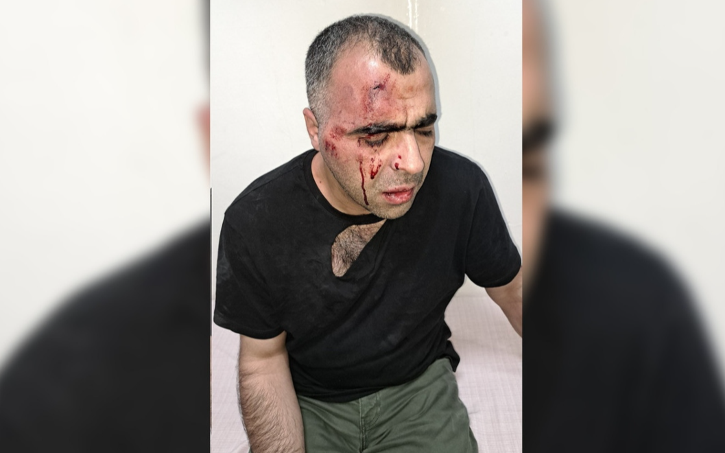 Gazeteci Sinan Aygül'e saldırıda 2 tutuklama