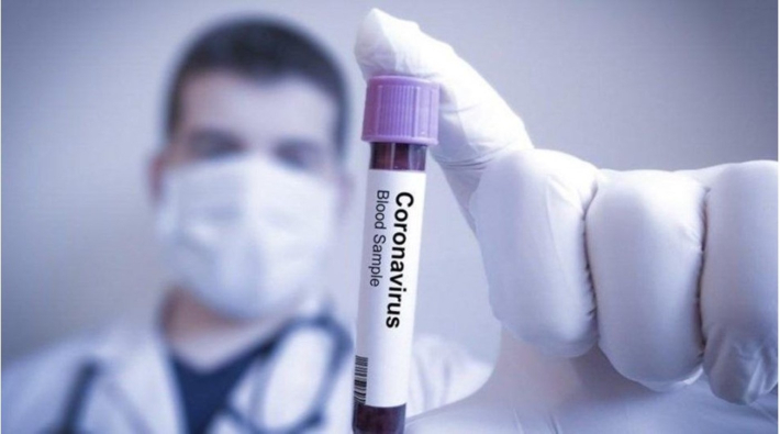 Vakalar artıyor koronavirüs can almaya devam ediyor: 151 kişi hayatını kaybetti