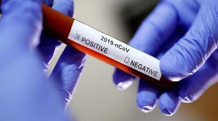 ABD, koronavirüs belirtileri listesine 6 yeni madde daha ekledi