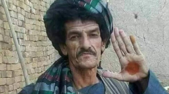 Afganistan'ın ünlü komedyeni Nazar Mohammad, Taliban tarafından katledildi