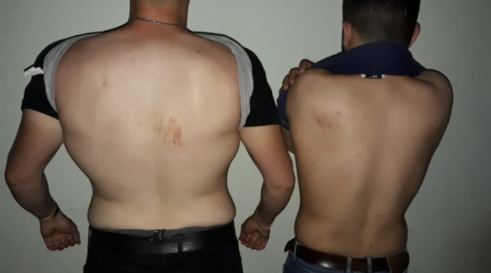 Iğdır'da bekçi şiddeti: Ters kelepçeyle gözaltına alınan 2 genç darp edildi