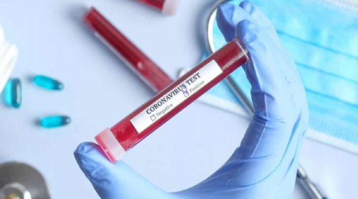 Çin Büyükelçiliği 15 dakikada sonuç veren koronavirüs testi üretildiğini duyurdu