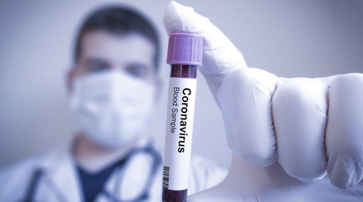 Fransız şirket 1 saatte sonuç veren koronavirüs testini duyurdu