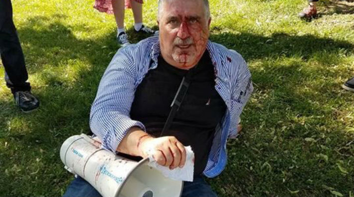 ABD’de korumalar tarafından saldırıya uğrayan protestocu: Talimatı bizzat Erdoğan verdi