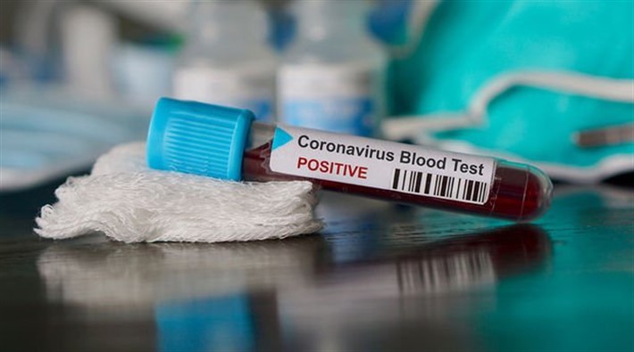 Dünya koronavirüs kıskacında |Dünya genelinde vaka sayısı 700 bini geçti