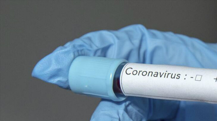 Resmi verilere göre son 24 saatte 159 kişi koronavirüs nedeniyle hayatını kaybetti