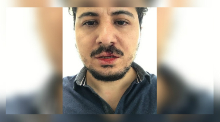 Türkiye salgın kıskacındayken: Bilecik'te hekime saldırı!