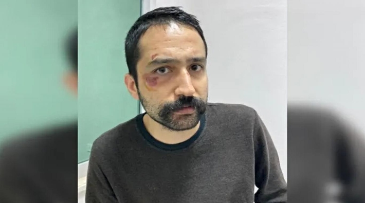 HHB: Tutuklu avukat Aytaç Ünsal’ın tedavisi engelleniyor