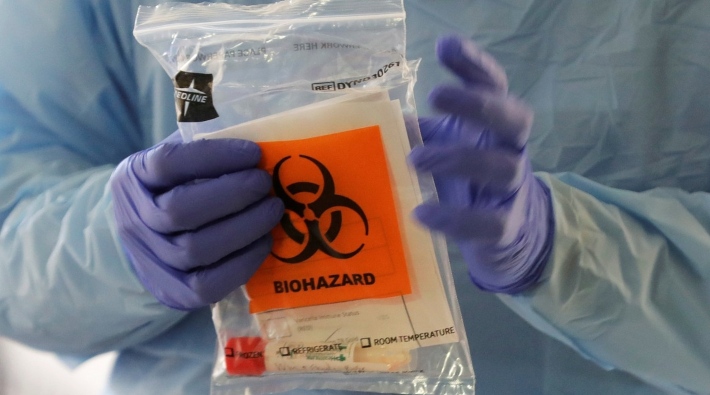 İngiltere, 'evde yapılabilecek' yeni bir koronavirüs testi üzerinde çalışıyor