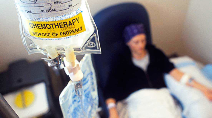 Kemoterapi sırasındaki saç kaybına yeni umut: Protein enjeksiyonu dökülmeyi durdurabilir