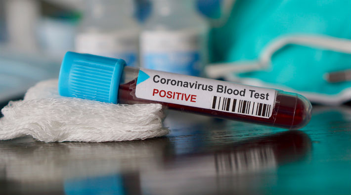 Koronavirüsle ilgili endişe verici gelişme: 100 bini aştı