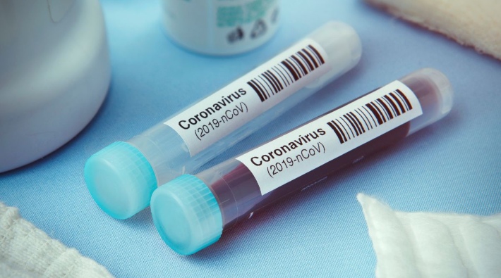 Koronavirüs aşısı bugün ilk kez test edilecek