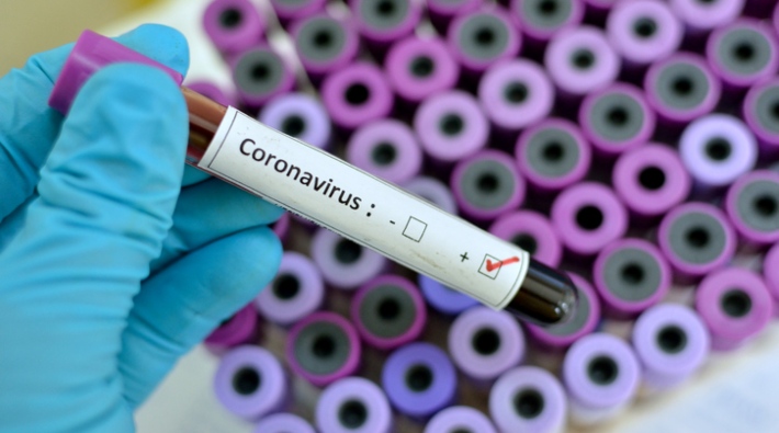 Koronavirüs sebebiyle hayatını kaybedenlerin sayısı 425'e yükseldi
