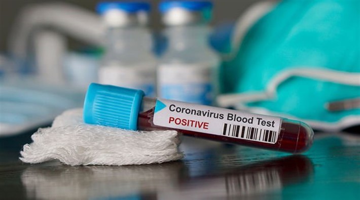 Çinli bilim insanları, hangi kan grubunun koronavirüse yakalanma riskinin daha yüksek olduğunu açıkladı