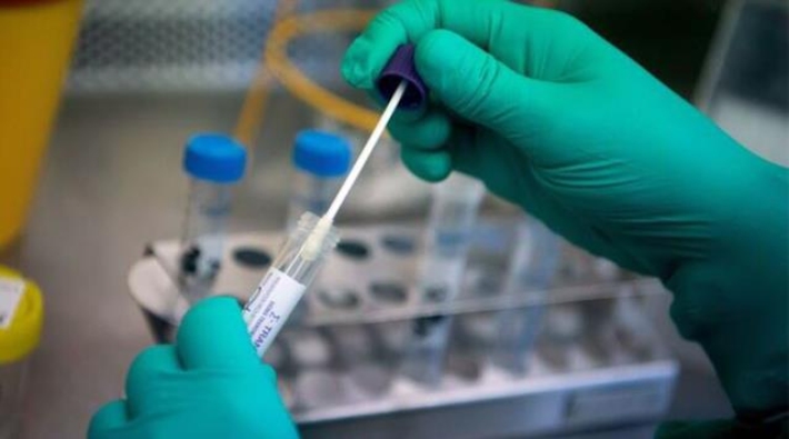Koronavirüsün PCR testlerinde gizlenebilecek yeni mutasyonu keşfedildi