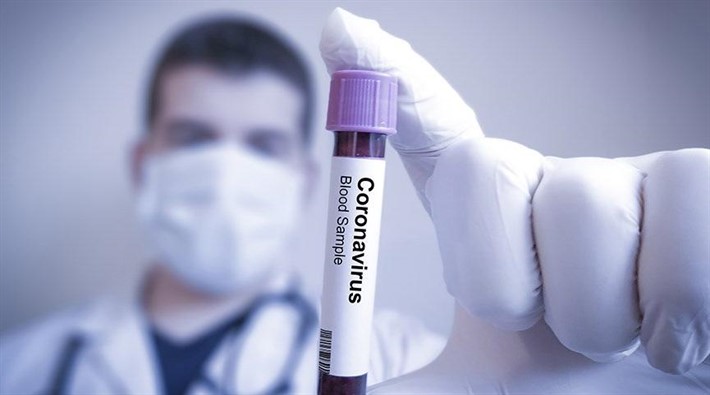 Koronavirüsün yeni bir belirtisi tespit edildi