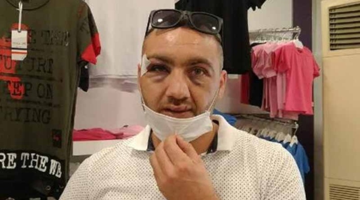 'Maske takın' uyarısı yapan mağaza müdürü, müşterinin saldırısına uğradı