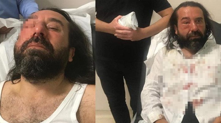 MHP yöneticisi, İmamoğlu'na destek veren İYİ Partili Bozkurt'a yapılan saldırıyı üstlendi