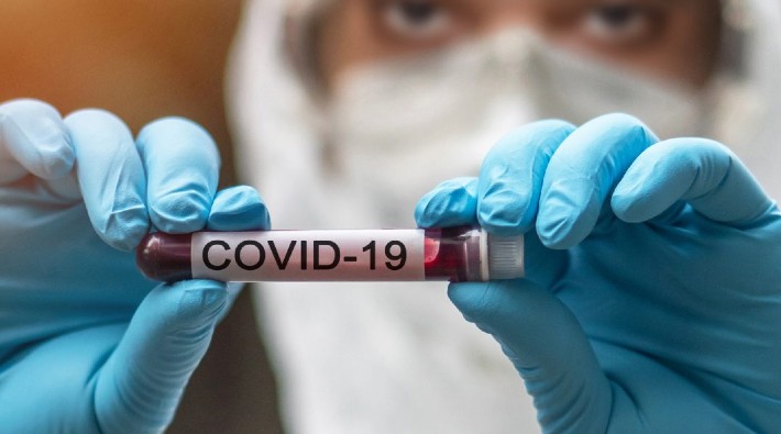 Resmi verilere göre son 24 saatte koronavirüs nedeniyle 242 kişi yaşamını yitirdi