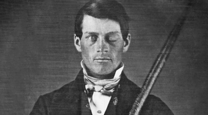 Phineas Gage vakası