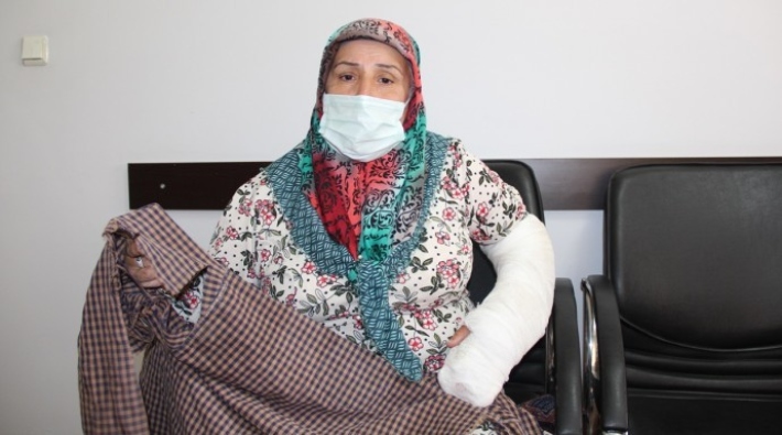 Soylu 'işkence yok' demişti: Polisin 55 yaşındaki kadının kolunu ve dişlerini kırması Meclis gündeminde