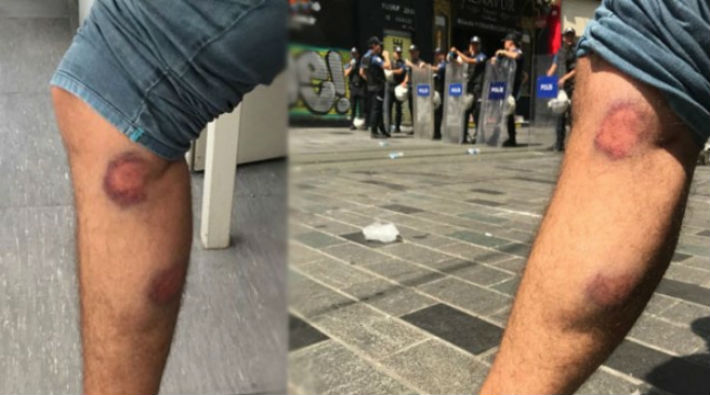 Polis'ten Gazeteciye Gazlı Mermi Saldırısı
