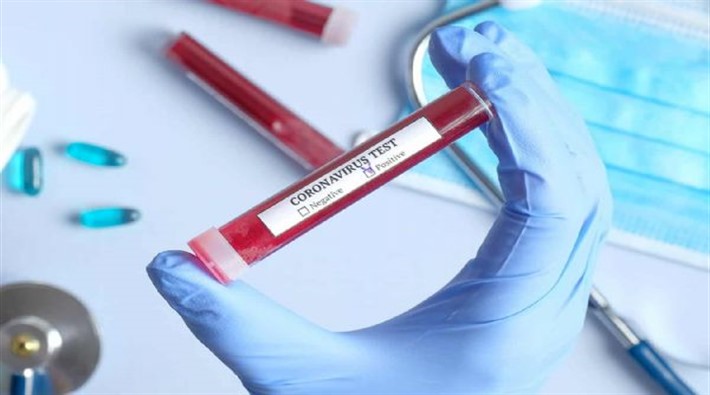 Sağlık Bakanlığı'ndan koronavirüs testlerine ilişkin yeni karar