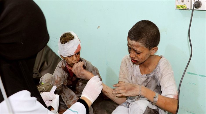 Suudiler Yemenli Çocuklara Saldırdı: 50 Ölü, 77 Yaralı 