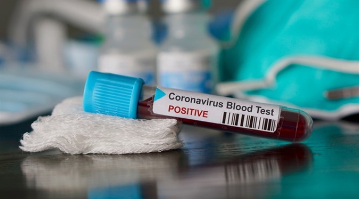 TTB: Koronavirüs korumalarını sağlayacak tıbbi malzeme yetersiz