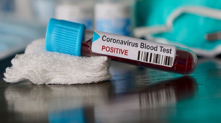 TTB: Koronavirüsün 18'den çok daha fazla kişide olduğuna dair duyum alıyoruz