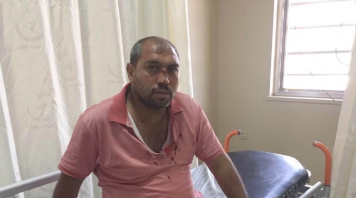 Urfa'da polis, sağlık emekçisinin burnunu kırdı