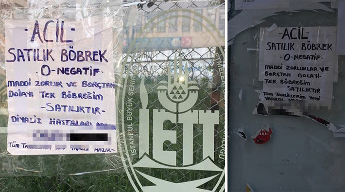 AKP Türkiyesi'nde yoksulluğun boyutu: İşsiz baba böbreğini satışa çıkardı!